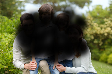 Feuchte AMD (spätes Stadium)